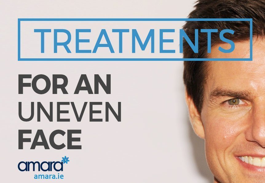 Botox Treatments for An Uneven Face - Amara Dublin