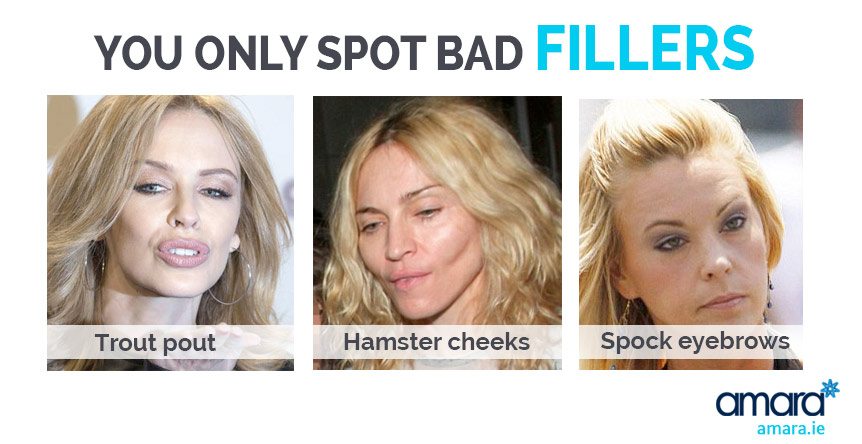 You only spot bad fillers