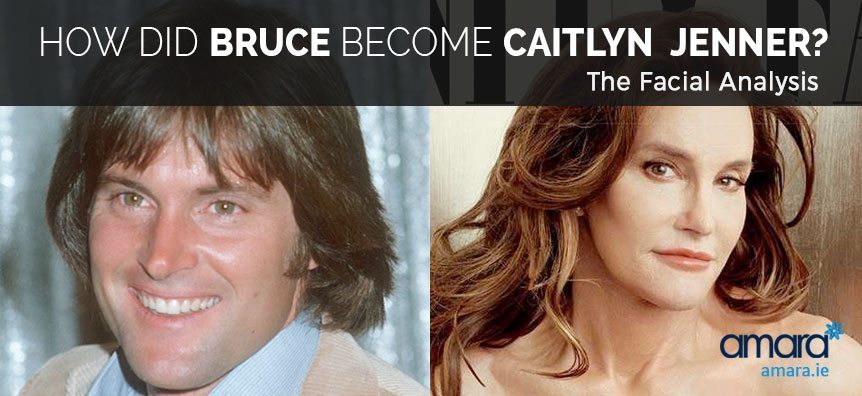 Bruce and Caitlyn Jenner - Before and After Photos