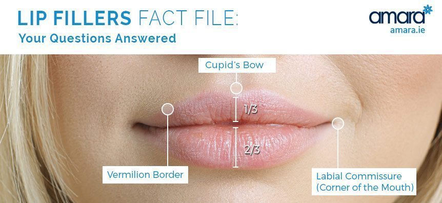 lip fillers treatment areas