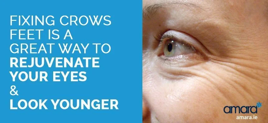 crows feet removal - eye rejuvenation