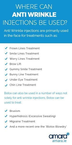 what can anti wrinkle injections be used for?