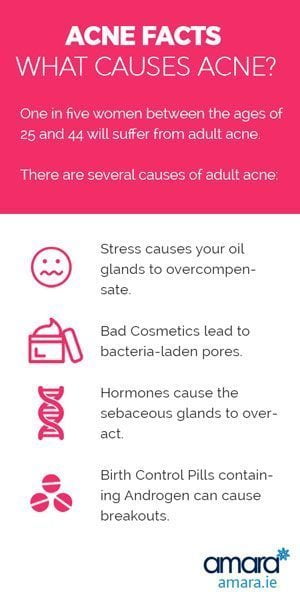 What Causes Acne - Acne Facts