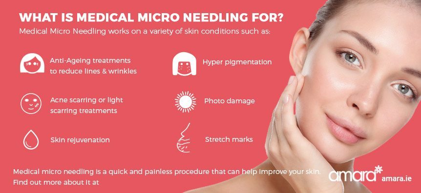 Uses of Medical Micro Needling - Amara Skincare Dublin