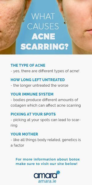 What Causes Acne Scarring?