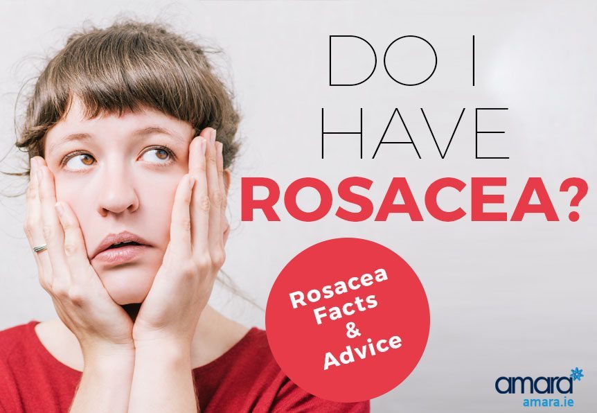 Do I Have Rosacea Rosacea Facts and advice