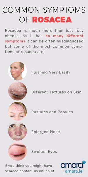 Symptoms of Rosacea