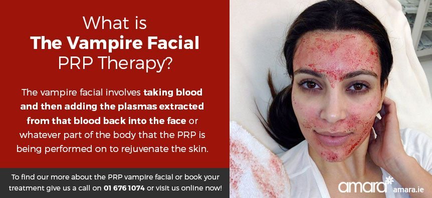 What Is The Vampire Facial?