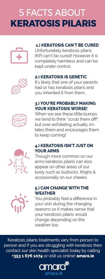 5 Facts About Keratosis Pilaris - Amara Clinics Dublin