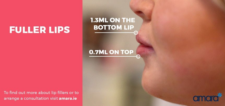 Fuller Lips - Lip Fillers Before and after photos