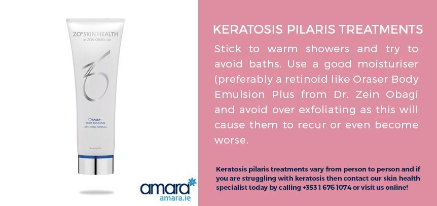 Keratosis Pilaris Treatment - Amara Skincare Clinic Dublin