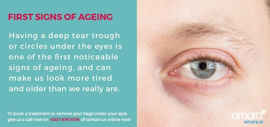 First Signs of Ageing - Bages Under The Eyes