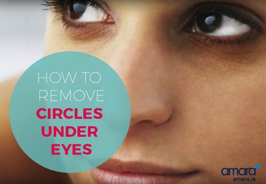 How to remove Circles Under Eyes - Amara Skincare Clinic Dublin