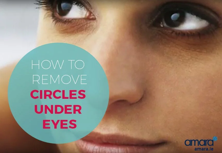 How to remove Circles Under Eyes Amara Skincare Clinic Dublin