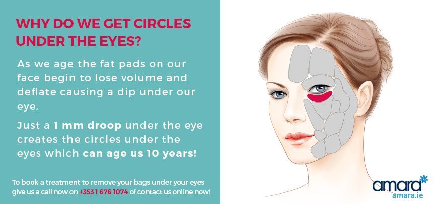 Why do we get circles under the eyes - Amara Skincare Clinic Dublin