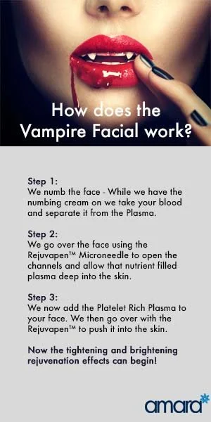 vampire-facial-amara-dublin