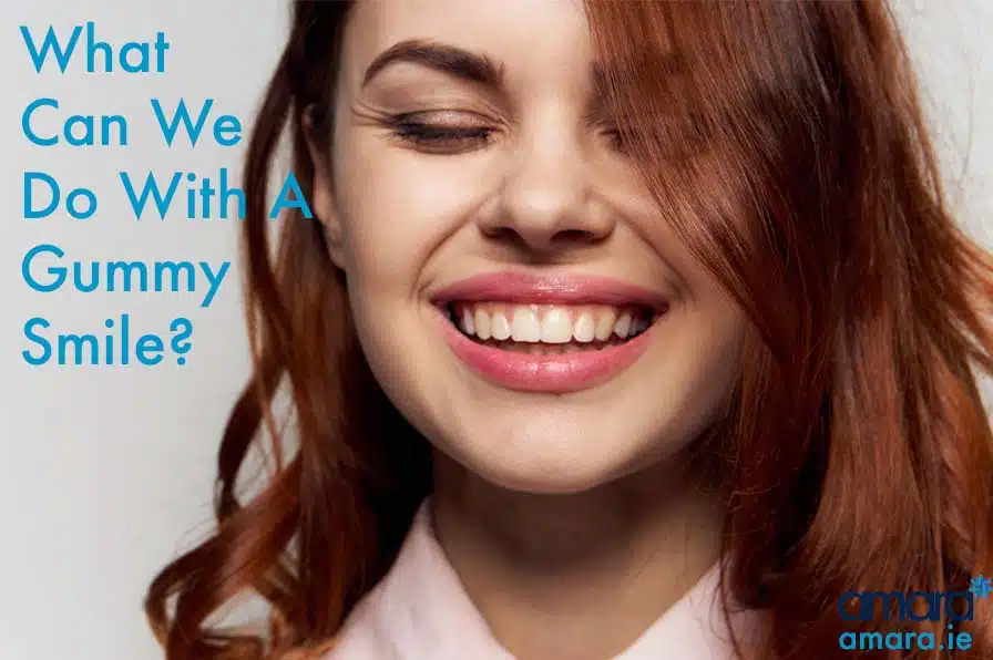 Gummy Smile Treatments Amara Dublin