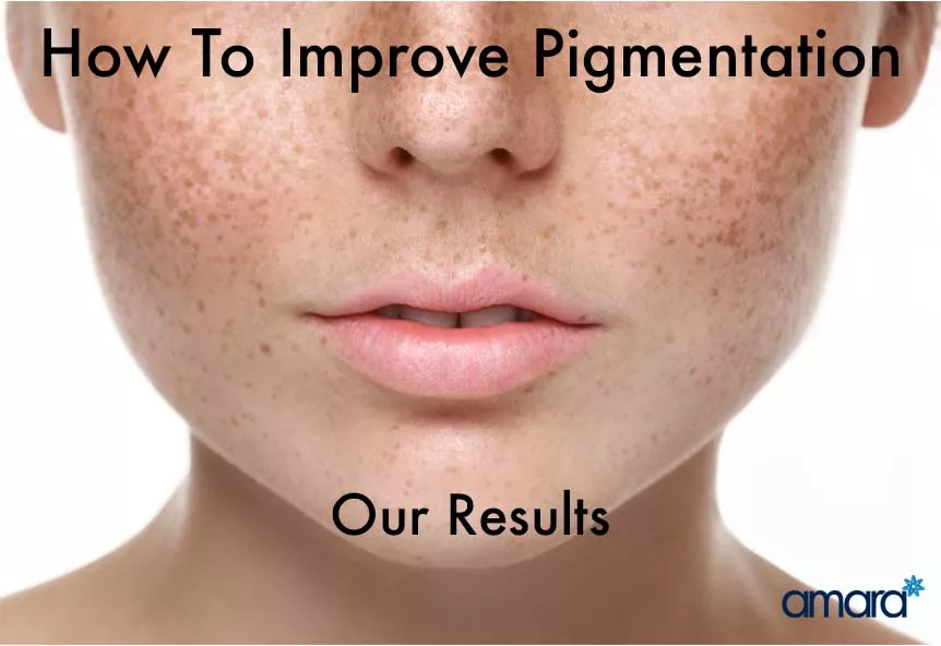 results of skin pigmentation treatment
