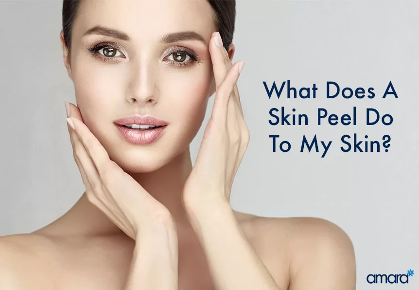 how do skin peels work?