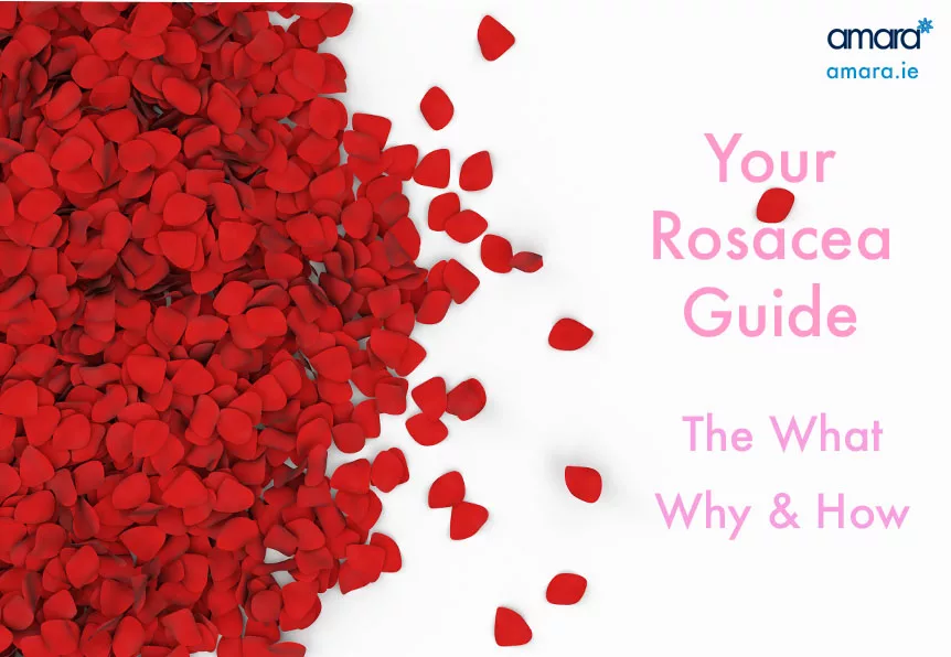 what is rosacea?