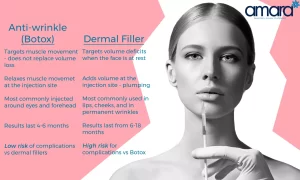 what is the difference between botox and fillers