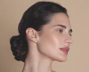 profhilo injections