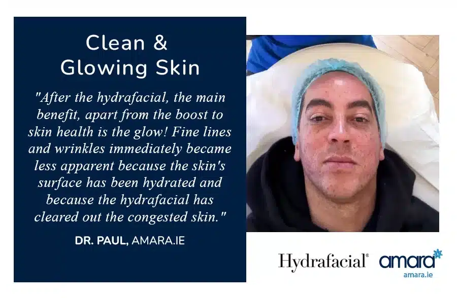 Glowing Skin Treatment Dublin - Hydrafacial - Amara