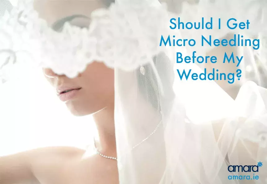 Micro Needling Before Wedding Amara Dublin
