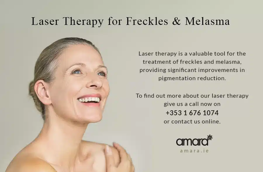 Laser Therapy Freckles Melasma Clinic Dublin - Amara